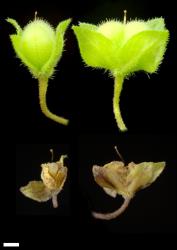 Veronica polita. Immature capsules (above), mature capsules (below). Scale = 1 mm.
 Image: P.J. Garnock-Jones © P.J. Garnock-Jones CC-BY-NC 3.0 NZ